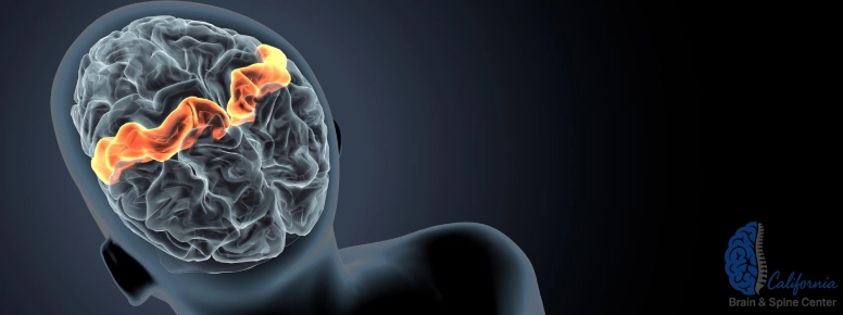 Concussion vs Mild TBI: Key Definitions, Misconceptions, and Grading Systems