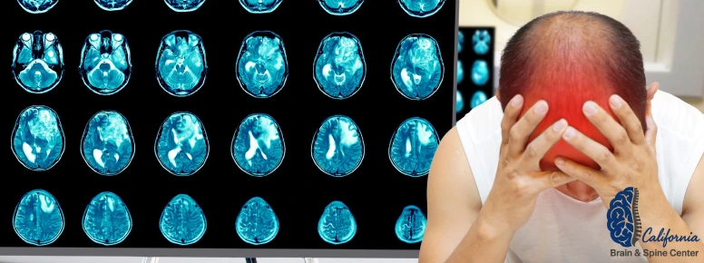 Concussion vs. Mild Traumatic Brain Injury: Understanding the Terminology