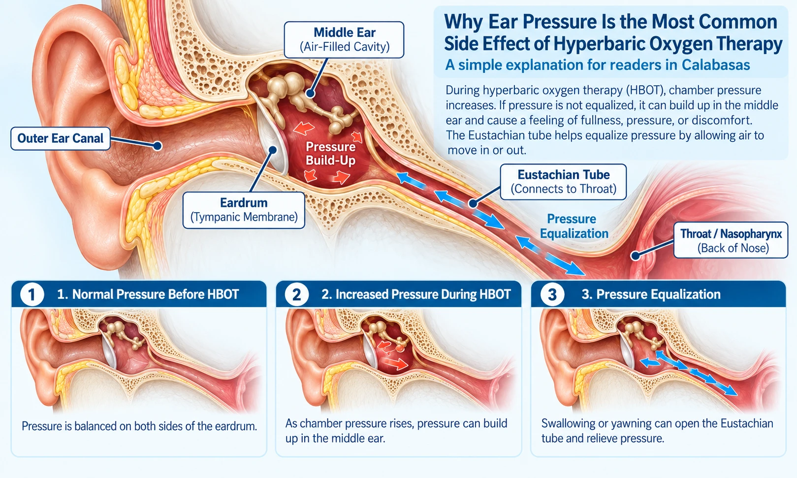 Diagram of the middle ear and Eustachian tube showing why ear pressure leads the list of hyperbaric oxygen therapy side effects, for readers in Calabasas